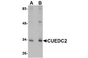 Western blot analysis of CUEDC2 in HeLa cell lysate with AP30262PU-N CUEDC2 antibody at (A) 1 and (B) 2 μg/ml. (CUEDC2 Antikörper  (C-Term))