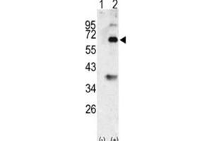 Western Blotting (WB) image for anti-Bone Morphogenetic Protein 3 (BMP3) antibody (ABIN2999248) (BMP3 Antikörper)