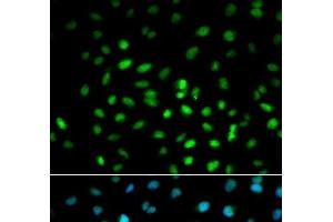 Immunofluorescence analysis of MCF-7 cells using LKB1 Polyclonal Antibody (LKB1 Antikörper)