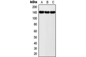 Western blot analysis of NOLC1 expression in MCF7 (A), SP2/0 (B), PC12 (C) whole cell lysates. (NOLC1 Antikörper  (C-Term))