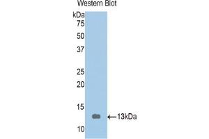 Western blot analysis of the recombinant protein. (Tropomodulin 1 Antikörper  (AA 39-138))