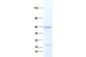 Western Blotting (WB) image for Zinc Finger Protein 707 (ZNF707) protein (His tag) (ABIN2736114)