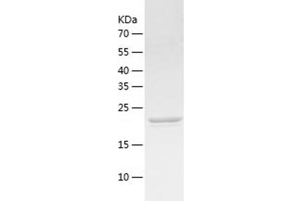 BASP1 Protein (AA 1-227) (His tag)