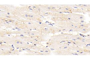 Detection of TTN in Human Cardiac Muscle Tissue using Polyclonal Antibody to Titin (TTN) (Titin Antikörper  (AA 33779-34025))