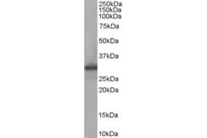 Western Blotting (WB) image for anti-Four and A Half LIM Domains 1 (FHL1) (Internal Region) antibody (ABIN2465696) (FHL1 Antikörper  (Internal Region))