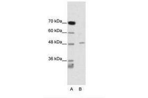 Image no. 1 for anti-Calcium Channel, Voltage-Dependent, beta 4 Subunit (CACNB4) (AA 361-410) antibody (ABIN6735460)