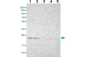 Western blot analysis of Lane 1: RT-4 Lane 2: U-251 MG Lane 3: Human Plasma Lane 4: Liver Lane 5: Tonsil with PDDC1 polyclonal antibody ( Cat # PAB28008 ) at 1:100 - 1:250 dilution.