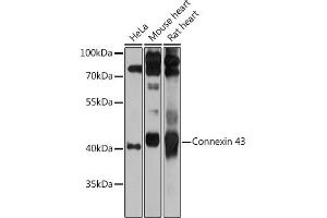 Western blot analysis of extracts of various cell lines, using Connexin 43 antibody (ABIN6131701, ABIN6141098, ABIN6141099 and ABIN6215448) at 1:1000 dilution. (Connexin 43/GJA1 Antikörper  (AA 233-382))