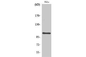 Western Blotting (WB) image for anti-Nuclear Factor of kappa Light Polypeptide Gene Enhancer in B-Cells 1 (NFKB1) (Thr147) antibody (ABIN3180207) (NFKB1 Antikörper  (Thr147))