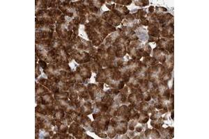 Immunohistochemical staining of human pancreas with ZNF341 polyclonal antibody  shows strong cytoplasmic positivity in exocrine cells at 1:200-1:500 dilution. (ZNF341 Antikörper)