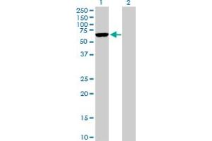 Western Blot analysis of ARMCX5 expression in transfected 293T cell line by ARMCX5 MaxPab polyclonal antibody. (ARMCX5 Antikörper  (AA 1-558))