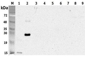 Western blot analysis using anti-CTRP5 (human), pAb  at 1:5'000 dilution. (CTRP5 Antikörper)