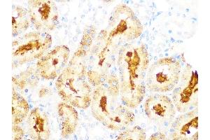 Immunohistochemistry of paraffin-embedded rat kidney using GCLC Rabbit mAb (ABIN1680604, ABIN3018993, ABIN3018994 and ABIN7101696) at dilution of 1:100 (40x lens). (GCLC Antikörper)