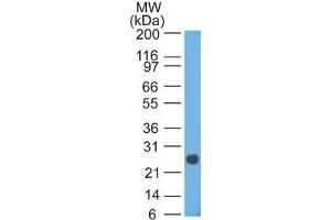 Western Blot analysis of human intestinal lysate using Lambda Light Chain Mouse Monoclonal Antibody (HP6054). (IgL Antikörper)