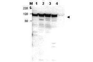 Western blot using  affinity purified anti-Myosin 1G antibody shows detection of a band ~100 kDa in size corresponding to Myosin 1G (arrowhead) in Myosin 1G positive whole cell lysate - lane 1 Jurkat, lane 2 peripheral blood T cells, lane 3 human spleen and lane 4 300. (MYO1G Antikörper  (Internal Region))