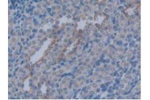 IHC-P analysis of Rat Kidney Tissue, with DAB staining. (Aquaporin 4 Antikörper  (AA 179-314))