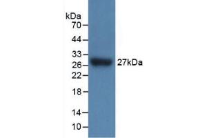 Western blot analysis of recombinant Mouse IL17RC.