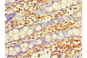 Immunohistochemistry of paraffin-embedded human colon tissue using ABIN7149619 at dilution of 1:100 (DHRS7 Antikörper  (AA 29-339))