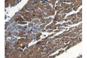 DAB staining on IHC-P; Samples: Rat Heart Tissue (NCOA3 Antikörper  (AA 1-269))