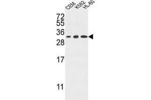 TSPAN2 Antibody (Center) western blot analysis in CEM,K562,HL-60 cell line lysates (35 µg/lane). (Tetraspanin 2 Antikörper  (Middle Region))