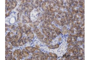 Immunoperoxidase of monoclonal antibody to CBS on formalin-fixed paraffin-embedded human pancreas. (CBS Antikörper  (AA 1-100))