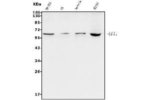 Western blot analysis of Lgi1/EPT/LGI1 using anti-Lgi1/EPT/LGI1 antibody (ABIN7601430).
