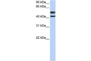 WB Suggested Anti-GNS Antibody Titration:  0.