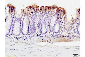 Formalin-fixed and paraffin embedded mouse intestine labeled with Anti-SUMO 1 Polyclonal Antibody, Unconjugated (ABIN687397) at 1:200 followed by conjugation to the secondary antibody and DAB staining. (SUMO1 Antikörper  (AA 21-101))