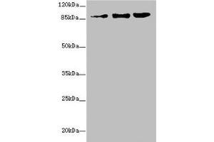 Western blot All lanes: ZNF148 antibody at 1.