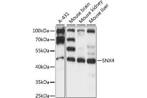 Western blot analysis of extracts of various cell lines, using SNX4 antibody (ABIN7270504) at 1:1000 dilution. (Sorting Nexin 4 Antikörper  (AA 1-250))