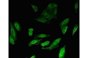 Immunofluorescent analysis of Hela cells using ABIN7160378 at dilution of 1:100 and Alexa Fluor 488-congugated AffiniPure Goat Anti-Rabbit IgG(H+L) (MYBL2 Antikörper  (AA 188-366))