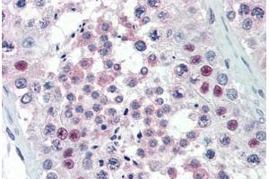 Human Testis (formalin-fixed, paraffin-embedded) stained with PRMT5 antibody ABIN337159 at 1:100 followed by biotinylated goat anti-rabbit IgG secondary antibody ABIN481713, alkaline phosphatase-streptavidin and chromogen. (PRMT5 Antikörper)