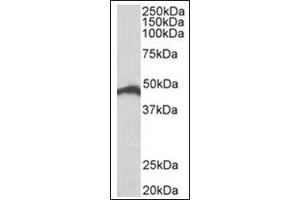 Staining of Jurkat lysate (35µg protein in RIPA buffer) using IRF4 antibody at 0. (IRF4 Antikörper  (C-Term))