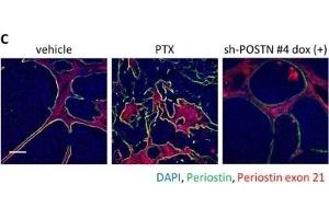 Immunofluorescence (Paraffin-embedded Sections) (IF (p)) image for anti-Periostin (POSTN) (C-Term) antibody (ABIN2854805)
