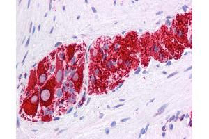 Anti-NR2E1 antibody IHC of human colon, myenteric plexus.