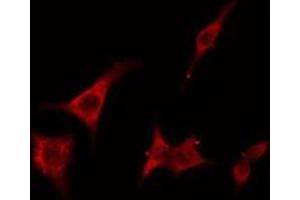 ABIN6275404 staining RAW264. (FNTB Antikörper  (Internal Region))