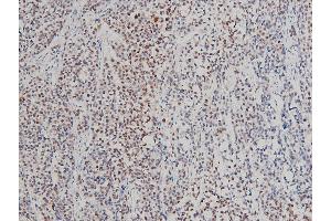 Immunohistochemistry (IHC) image for anti-LIM Domain Kinase 1 (LIMK1) (pThr508) antibody (ABIN6255701)
