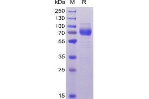 SDS-PAGE (SDS) image for CD33 (CD33) (AA 18-259) protein (Fc-His Tag) (ABIN6961110)