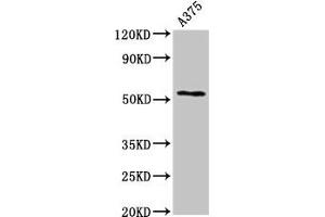 Western Blot Positive WB detected in: A375 whole cell lysate All lanes: CPE antibody at 2. (CPE Antikörper  (AA 252-363))