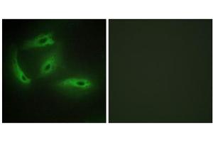 Immunofluorescence analysis of HeLa cells, using CDKL4 antibody. (CDKL4 Antikörper  (C-Term))