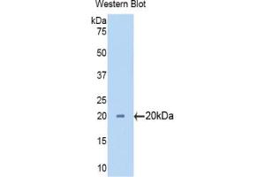 Western blot analysis of the recombinant protein. (CYP3A7 Antikörper  (AA 344-497))