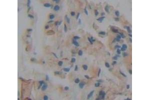 IHC-P analysis of Human Tissue, with DAB staining. (SFRP1 Antikörper  (AA 32-314))