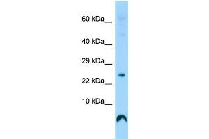 Host: Rabbit Target Name: C17orf108 Sample Type: Fetal Heart lysates Antibody Dilution: 1. (LYRM9 Antikörper  (Middle Region))