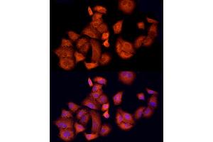 Immunofluorescence analysis of A-549 cells using  Rabbit pAb (ABIN1678685, ABIN3015308, ABIN3015309 and ABIN6213977) at dilution of 1:150 (40x lens).