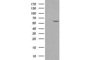 Western Blotting (WB) image for anti-Phosphoribosyl Pyrophosphate Amidotransferase (PPAT) (AA 42-278) antibody (ABIN1491504)