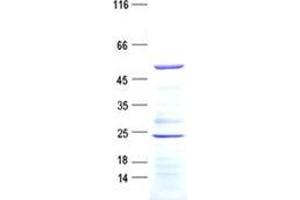 Validation with Western Blot (ARHGAP8 Protein (His tag))
