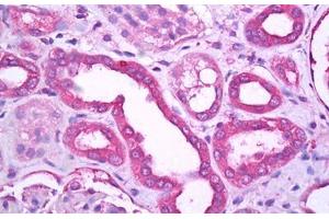 Anti-TRPM7 antibody IHC staining of human kidney, tubules.