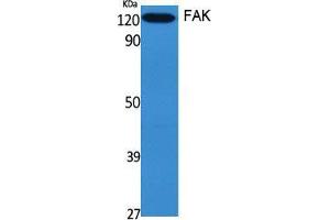 Western Blotting (WB) image for anti-PTK2 Protein tyrosine Kinase 2 (PTK2) (Thr451) antibody (ABIN6284357)