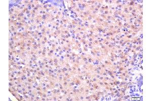 Formalin-fixed and paraffin embedded rat pancreas tissue labeled with Rabbit Anti-CTDSP2 Polyclonal Antibody, Unconjugated (ABIN2559702) at 1:200 followed by conjugation to the secondary antibody and DAB staining (CTDSP2 Antikörper  (AA 25-150))