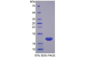 SDS-PAGE analysis of Mouse Osteoglycin Protein. (OGN Protein)
